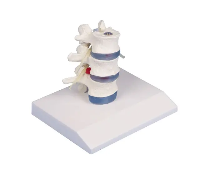 Lumbal Prolapsmodell - 4047 